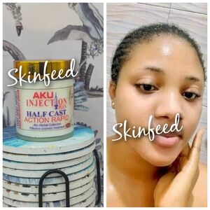 Aku Herbal Plus H.C Action Rapid Day And Night Face And Body Cream 380ml
